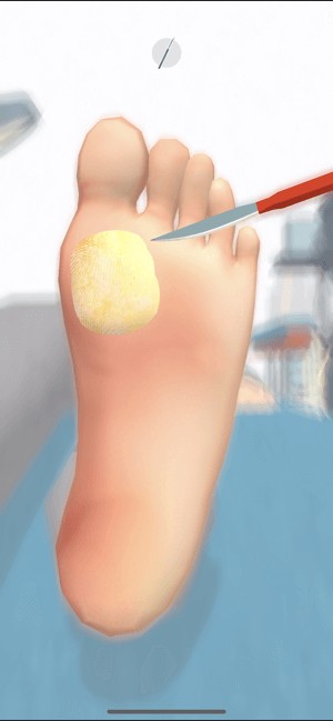 Điều trị chân cho các bệnh nhân