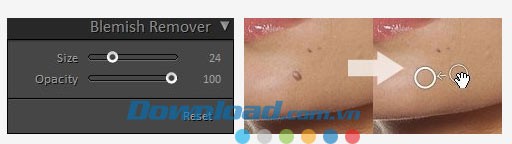 Free Photo Blemish Remover